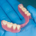 Exploring the Advantages of Partial Dentures for Missing Teeth