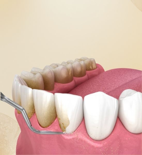 The Role of Periodontal Treatments in Preventing Tooth Loss